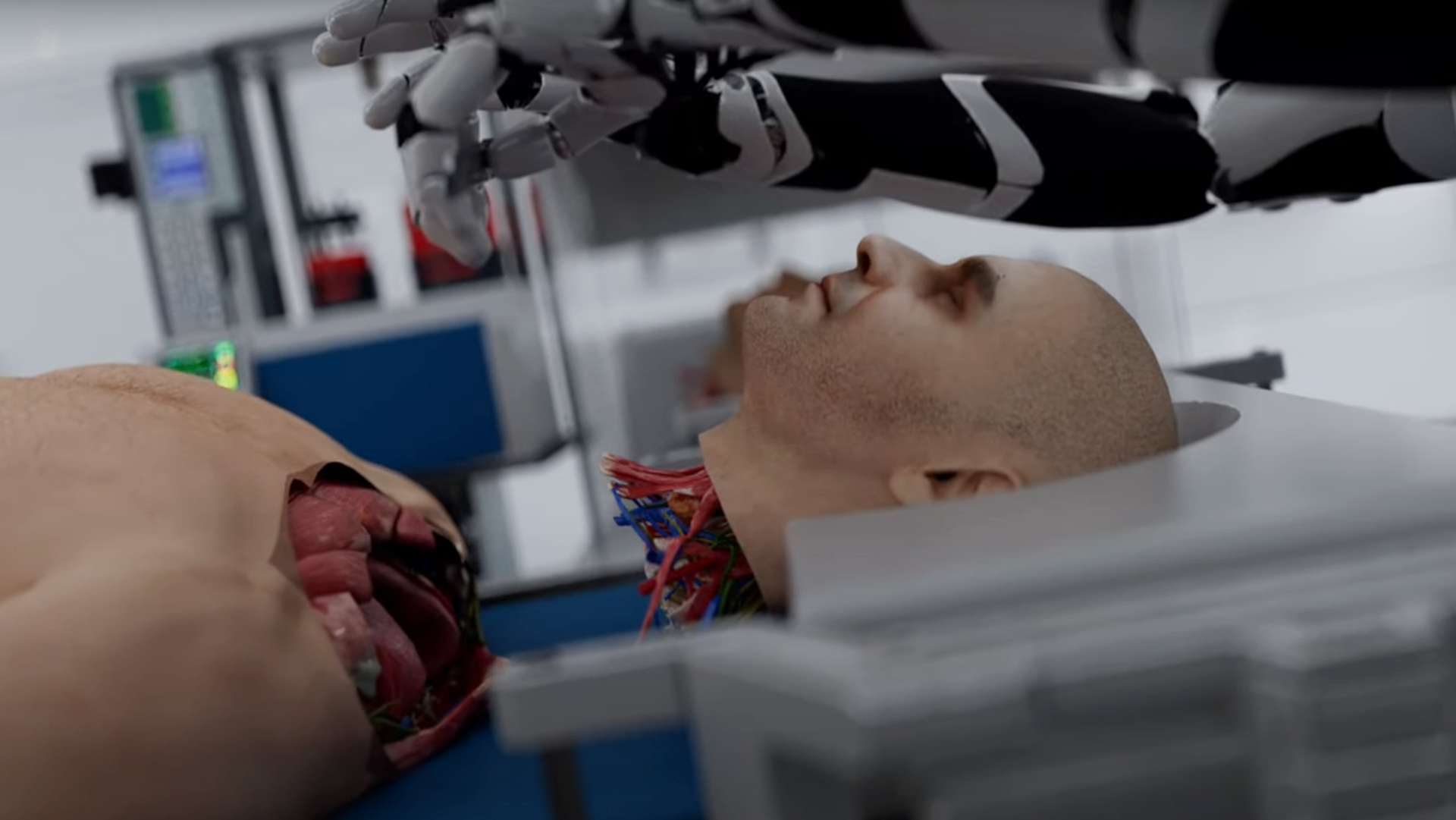 Revolutionizing Medicine: The Future of Head Transplants